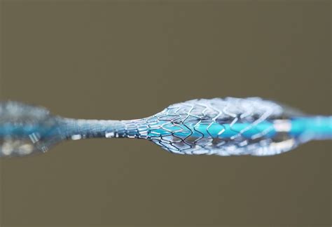  Nitinol: L’alliage mémoire à formes incroyables pour applications médicales de pointe !